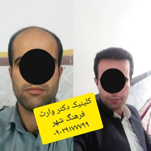 کلینیک تخصصی پوست و مو دکتر بهروز وارث (شیراز)
